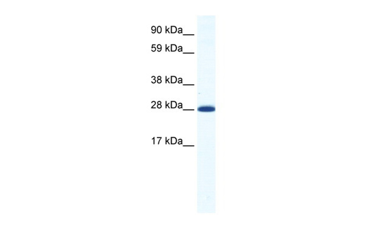 Antibody used in WB on Mouse NIH-3T3 at 1.25 ug/ml.