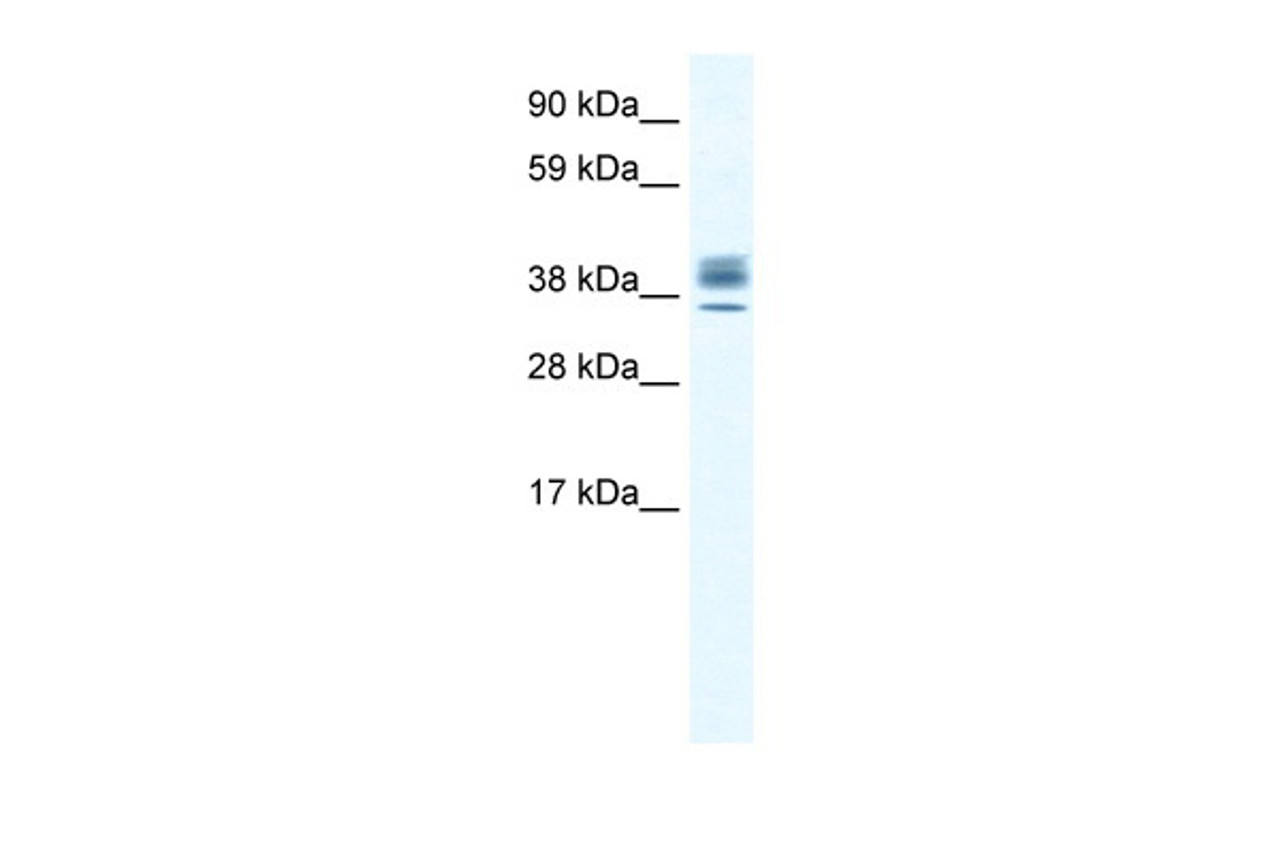 Antibody used in WB on Human Testis at 2.5 ug/ml.