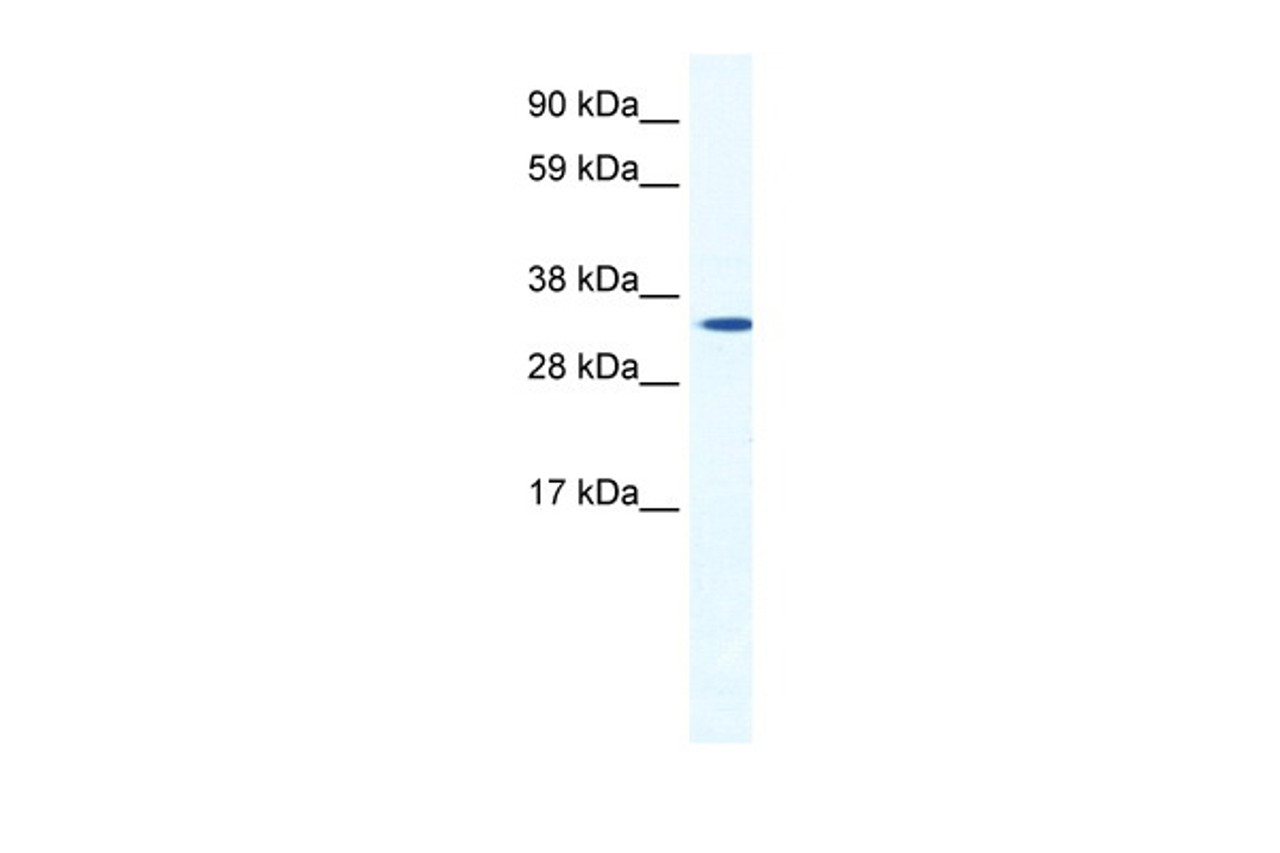 Antibody used in WB on Mouse NIH-3T3 at 1.25 ug/ml.