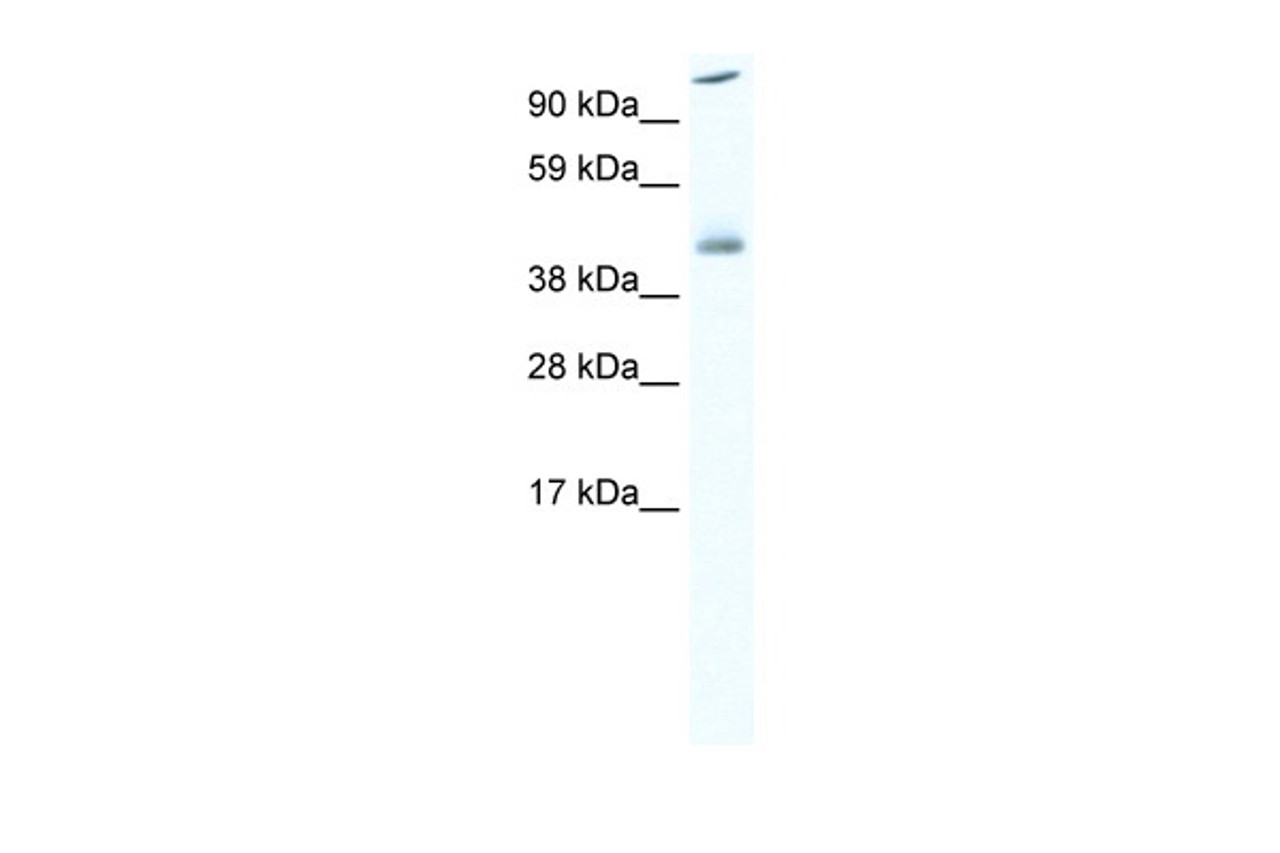 Antibody used in WB on Mouse SP2/0 at 0.06125 ug/ml.