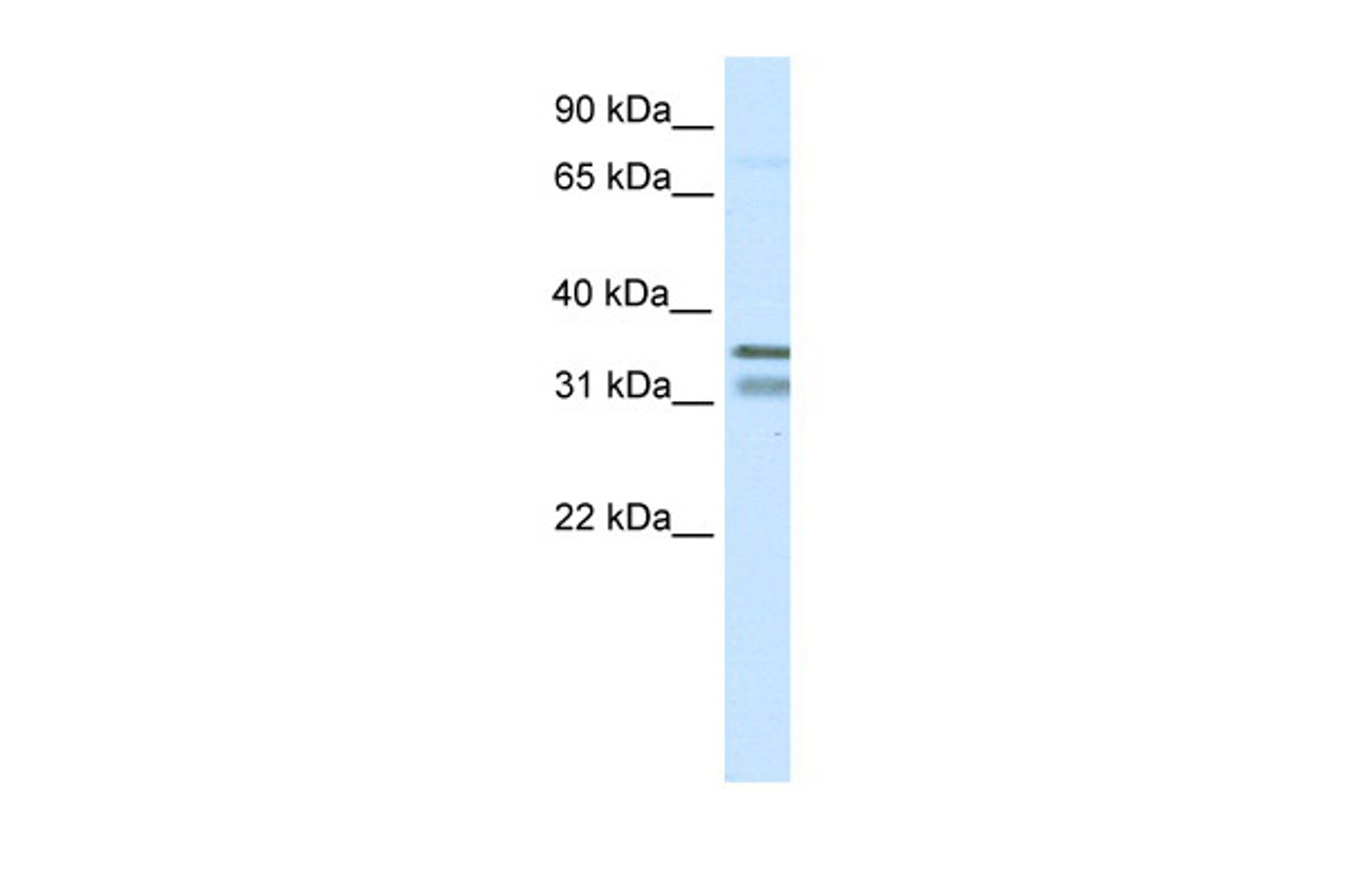 Antibody used in WB on Mouse SP2/0 at 0.125 ug/ml.