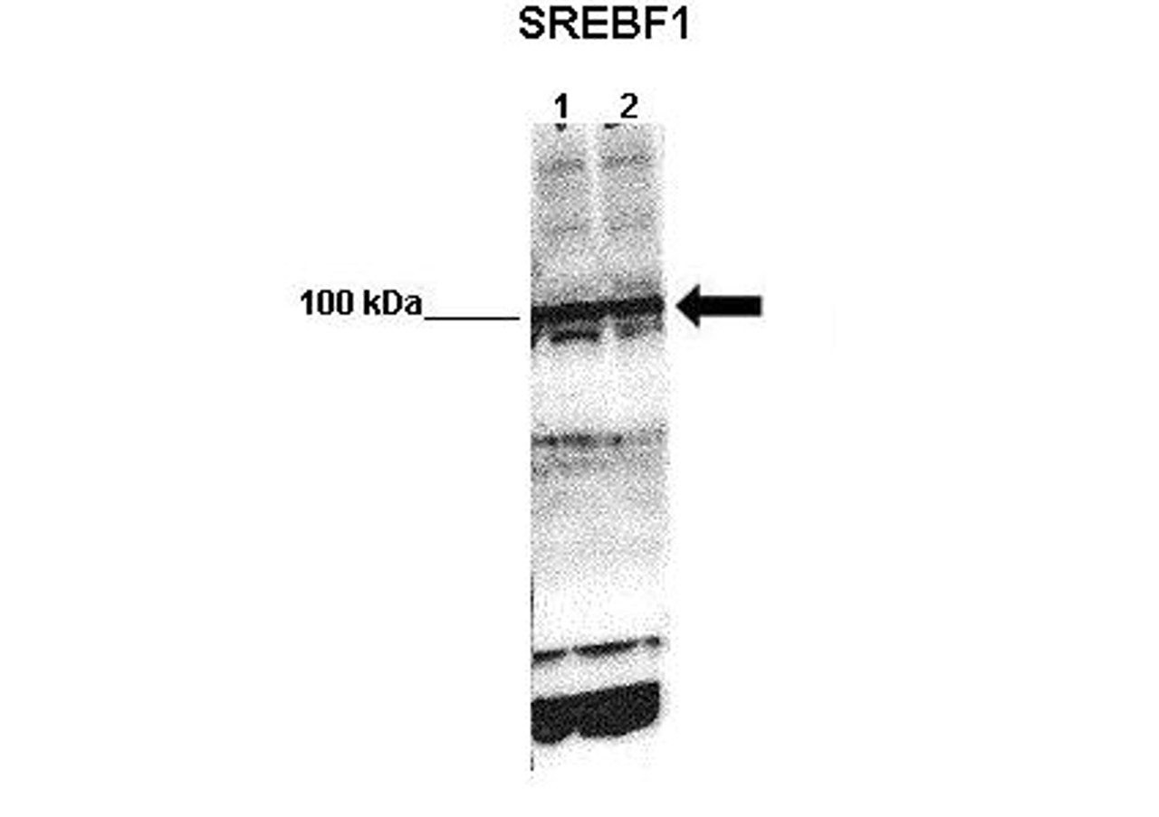 Antibody used in WB on mouse glomerular endothelial at 1:1000 (Lane 1: 50ug mouse glomerular endothelial lysate Lane 2: 50ug mouse glomerular endothelial lysate ) .