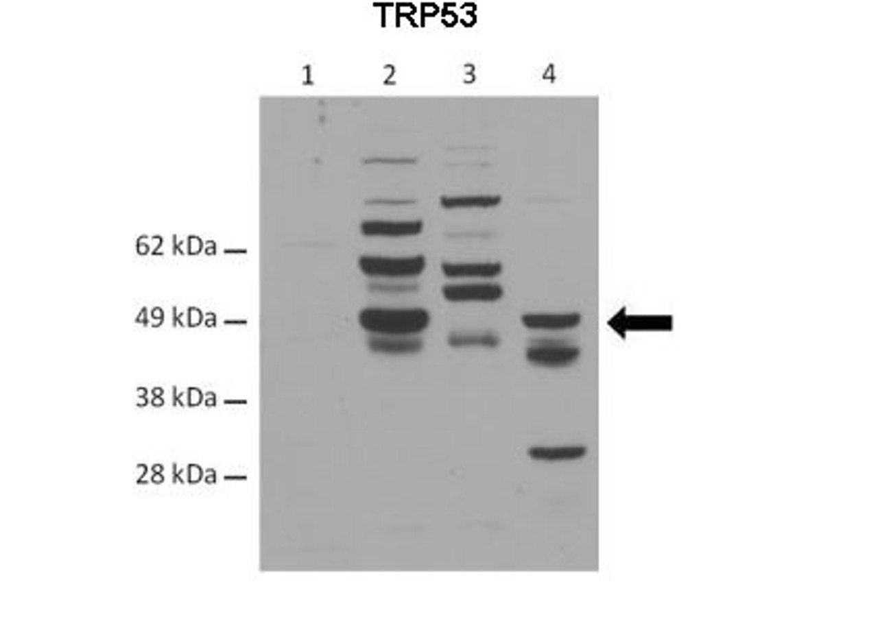 Antibody used in WB on Mouse at 1:1000 (Lane 1: 40ug C57/B6 control mouse G.I. Lane 2: 40ug C57/B6 mouse G.I. treated with Irinotecan Lane 3: 40ug p53 KO HCT-116 cells Lane 4: 40ug C57/B6 mouse treated with 15 Gy ionizing radiation ) .