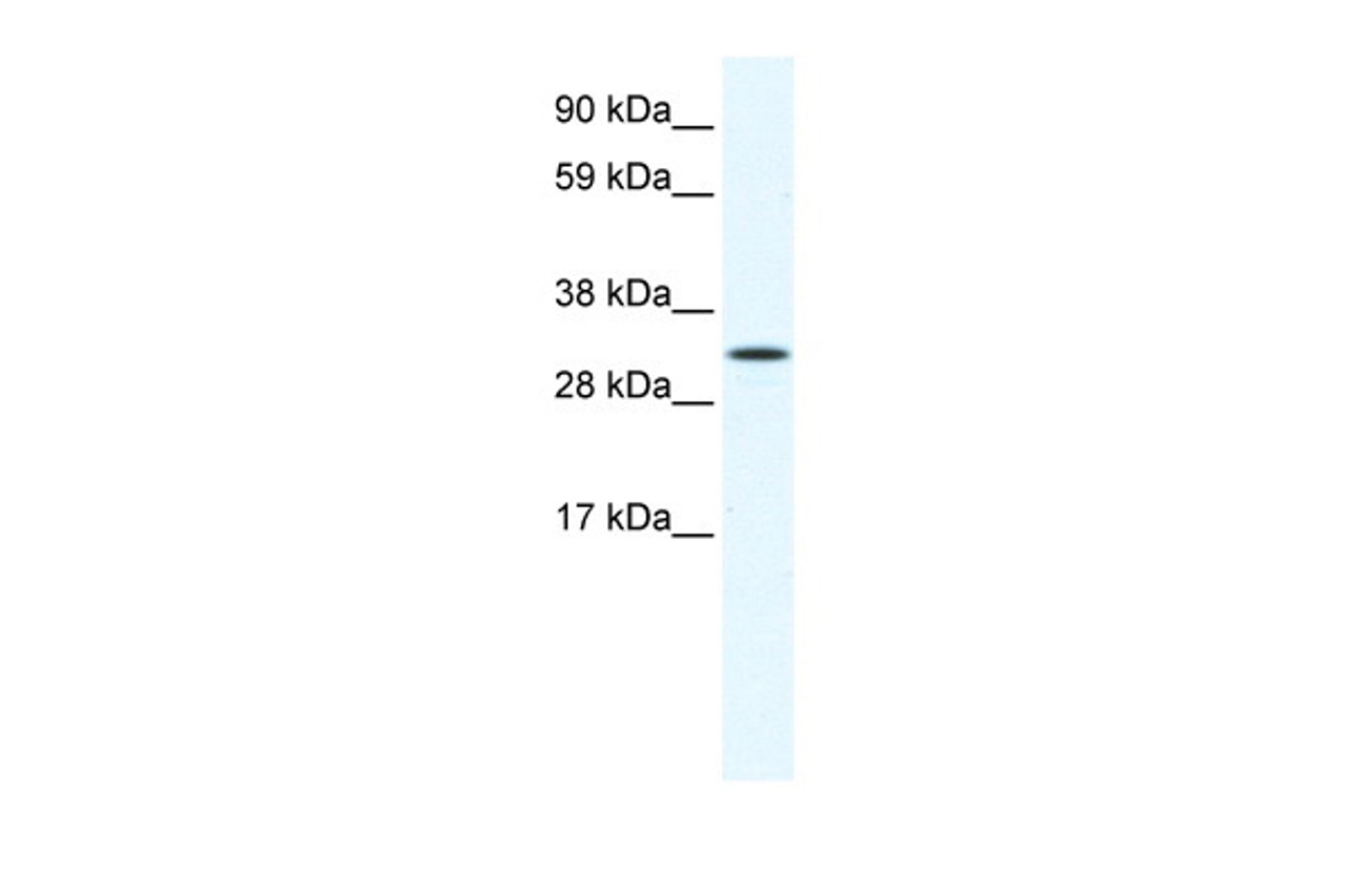 Antibody used in WB on Mouse NIH-3T3 at 1.25 ug/ml.