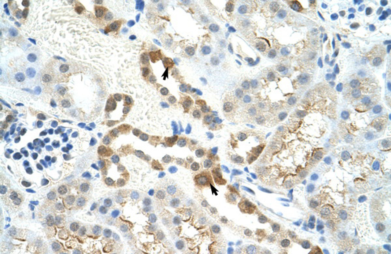 Antibody used in IHC on Mouse Lung.
