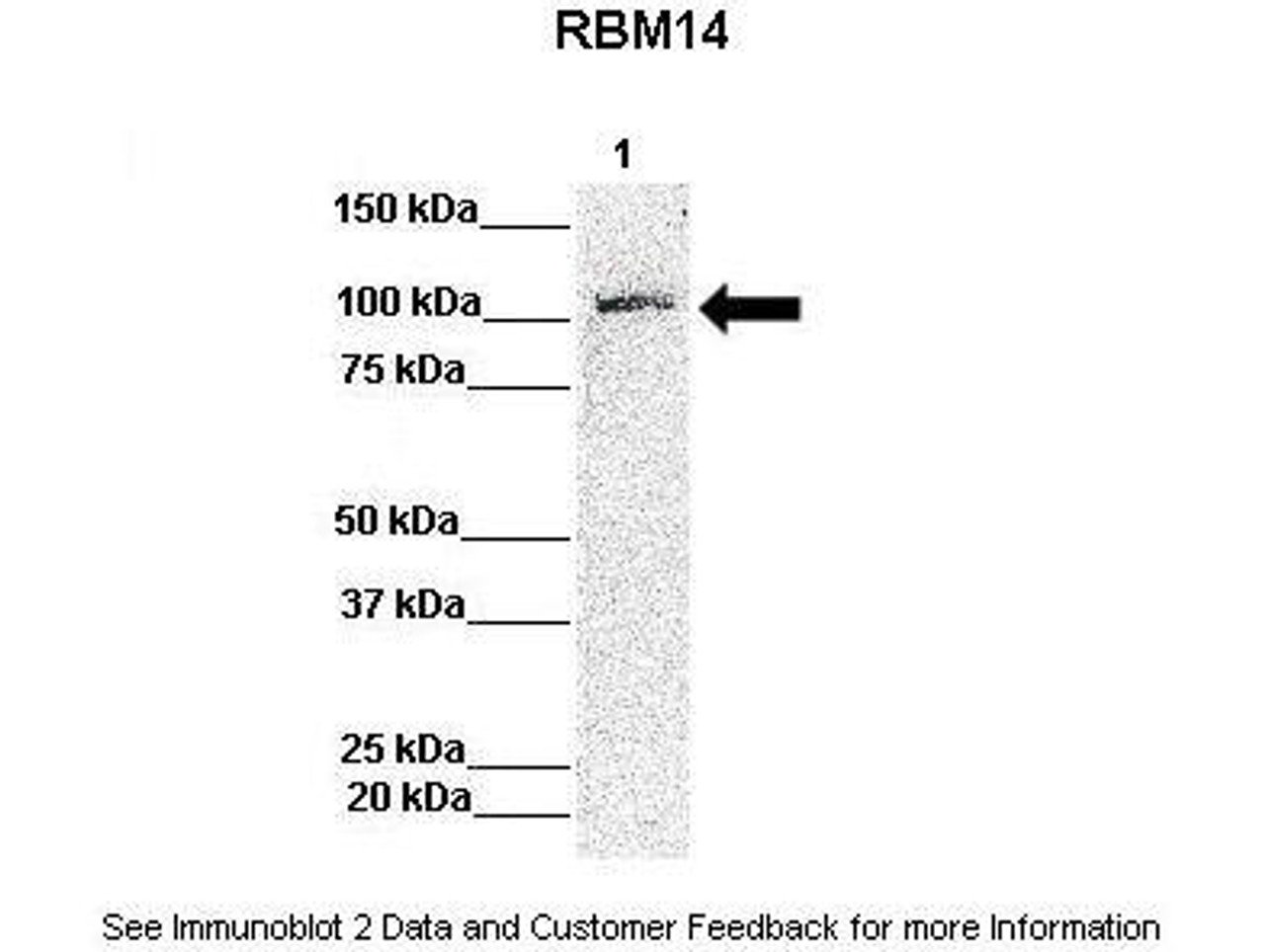 Antibody used in WB on Human HeLa at: 1:1000.