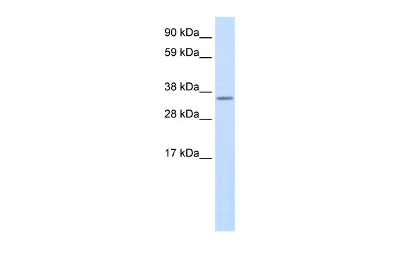 Antibody used in WB on Mouse SP2/0 at 0.2-1 ug/ml.