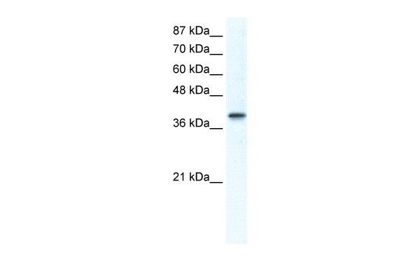 Antibody used in WB on Human Jurkat 1.25 ug/ml.