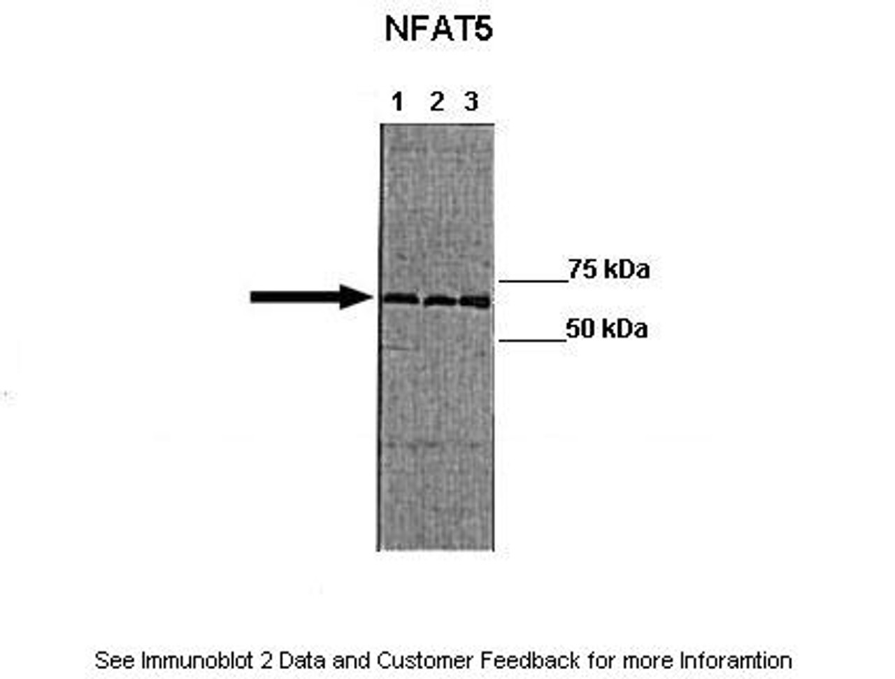 Antibody used in WB on HT-29 at: 1:1000 (Lane 1: 20ug HT 29 lysate blocked with 5% FBS Lane 2: 20ug HT 29 lysate blocked with no FBS Lane 3: 20ug HT-29 lyaste blocked with no PBS + 100 mM NaCl ) .