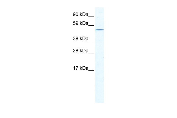 Antibody used in WB on Human Adrenal Gland at 0.3125 ug/ml.