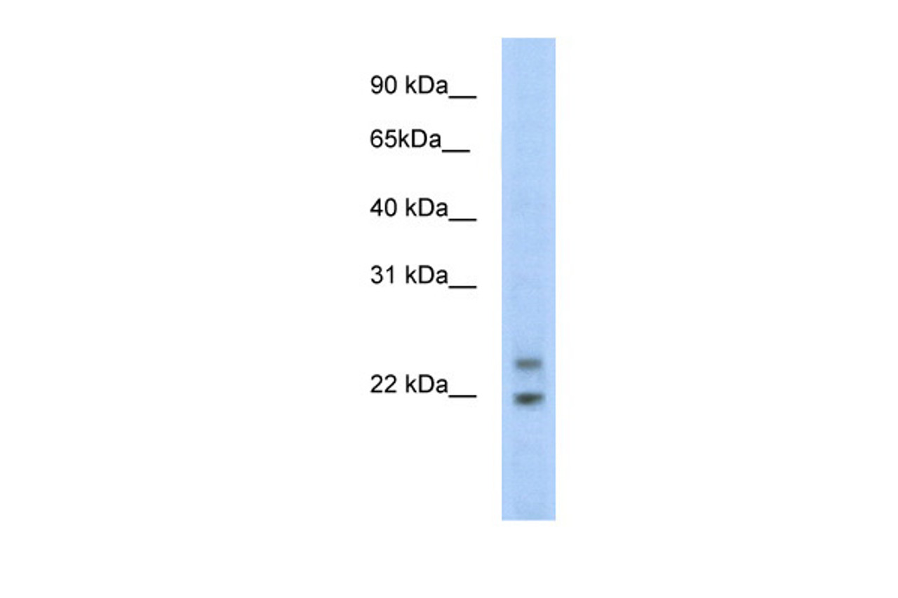 Antibody used in WB on Mouse SP2/0 at 5.0 ug/ml.