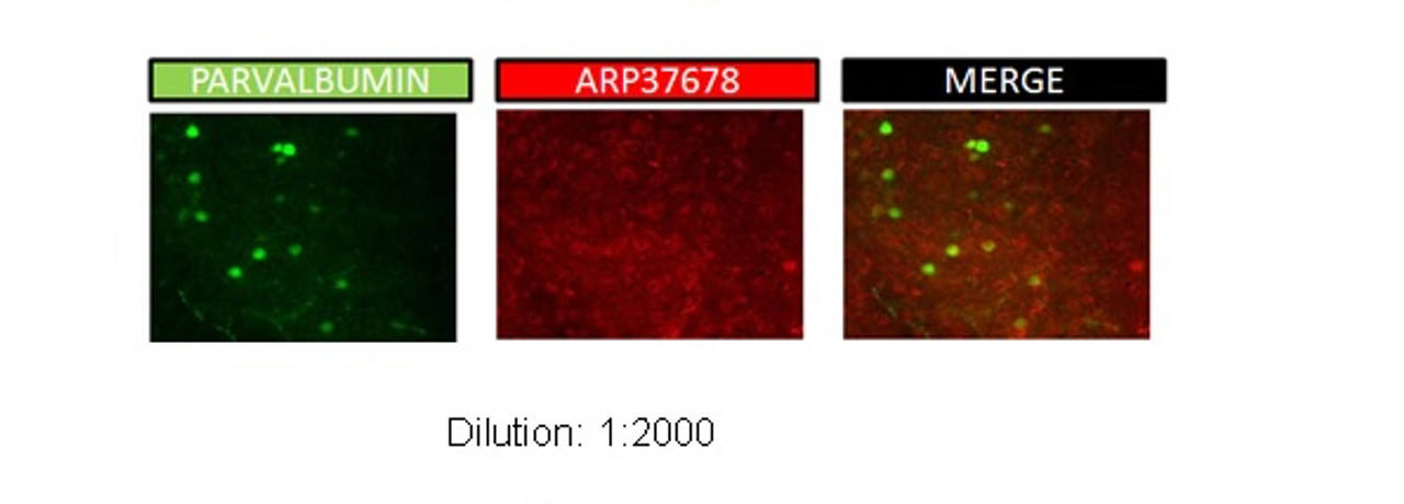 Antibody used in IHC on Mouse Brain at 1:2000.