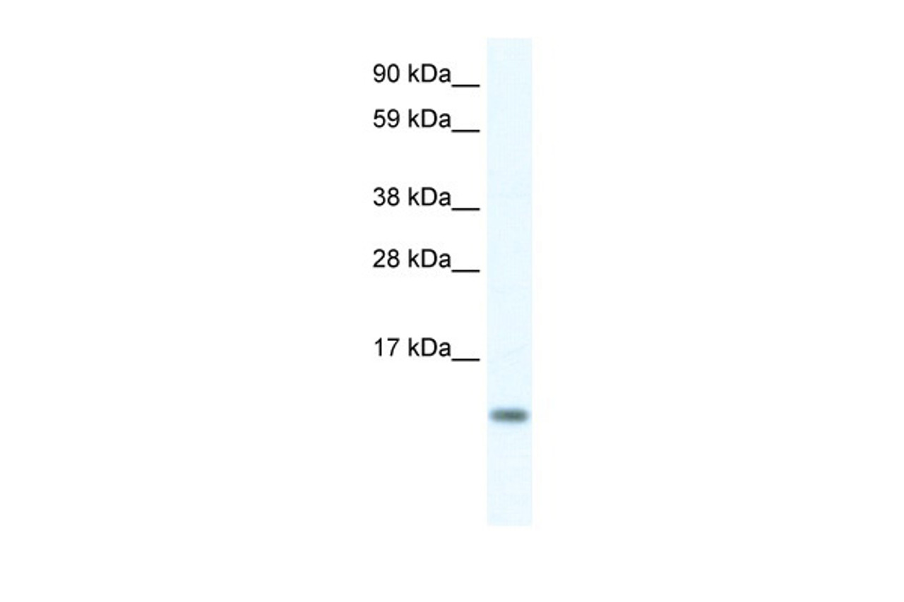 Antibody used in WB on Human Placenta at 0.625 ug/ml.