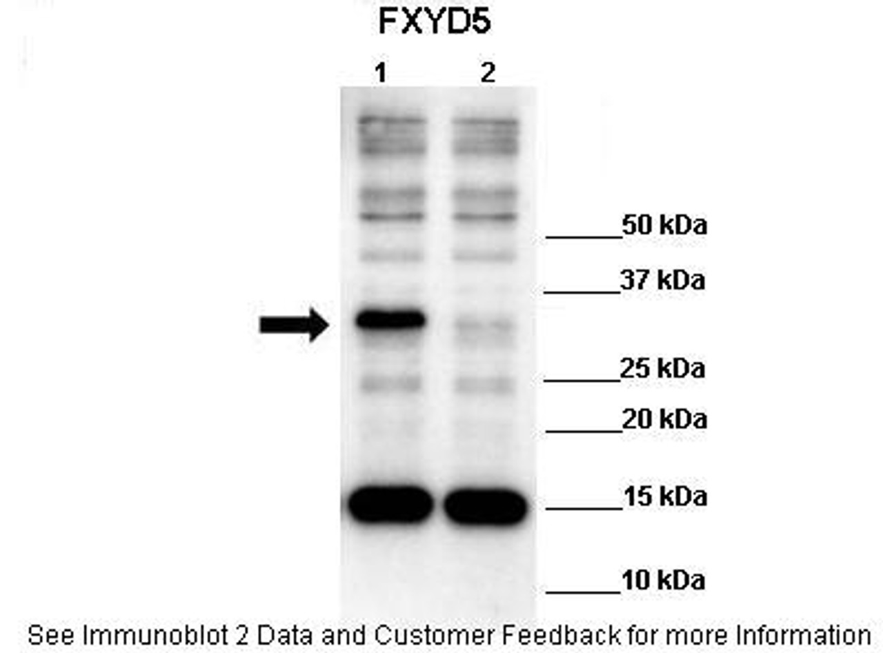 Antibody used in WB on Human 293T at: 1:1000 (Lane 1: 10ug hFXYD5 transfected 293T lysate, Lane 2: 10ug 293T lysate) .