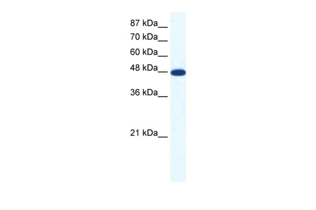 Antibody used in WB on Human Jurkat 1.25 ug/ml.