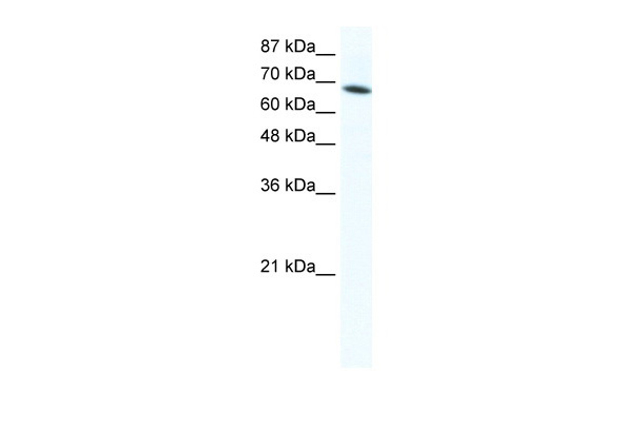 Antibody used in WB on Human Jurkat 1.25 ug/ml.