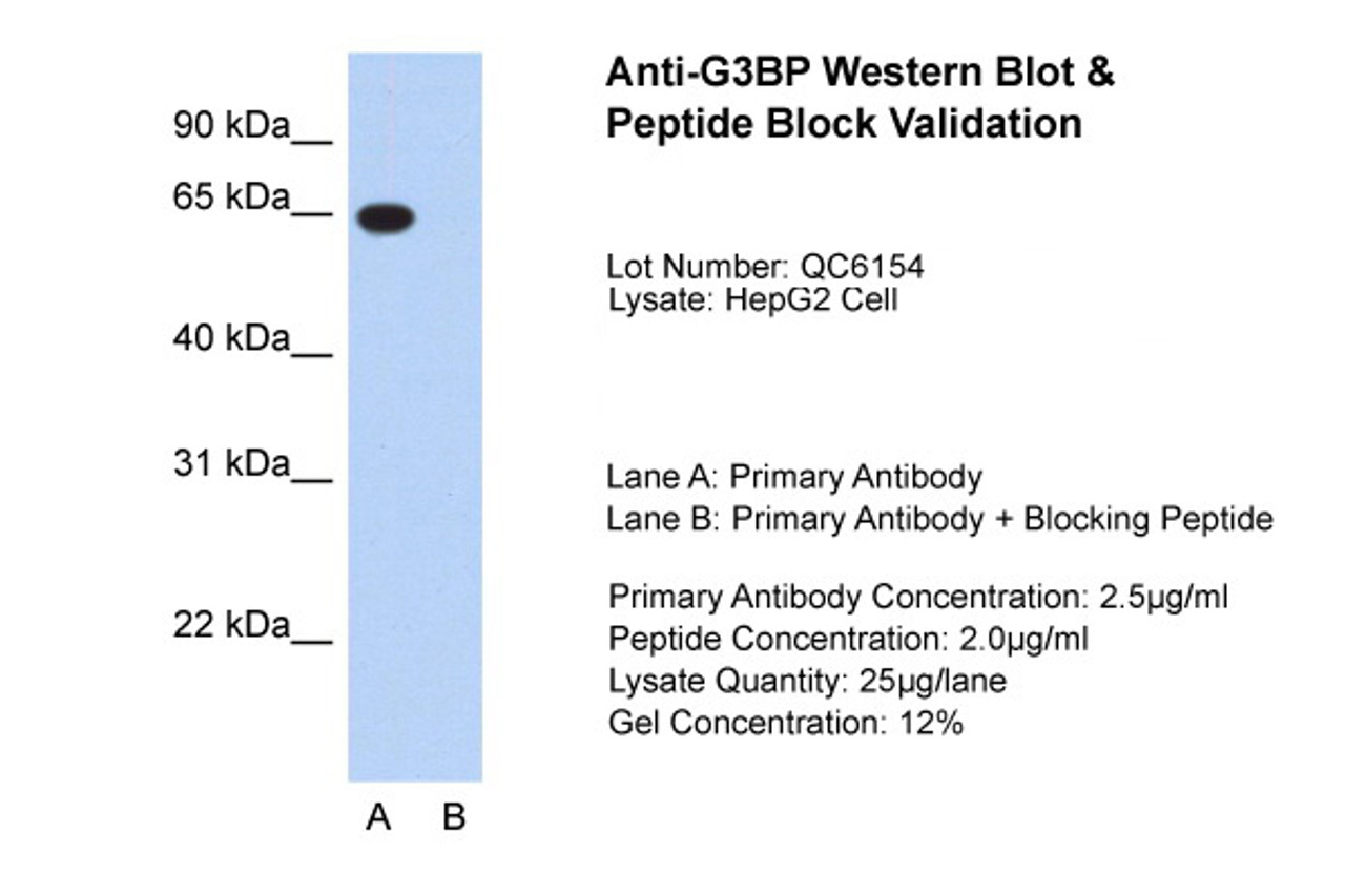 Antibody used in WB on HepG2 at 2.5 ug/ml (Lane A: Primary Antibody and Lane B: Primary Antibody + Blocking Peptide ) .