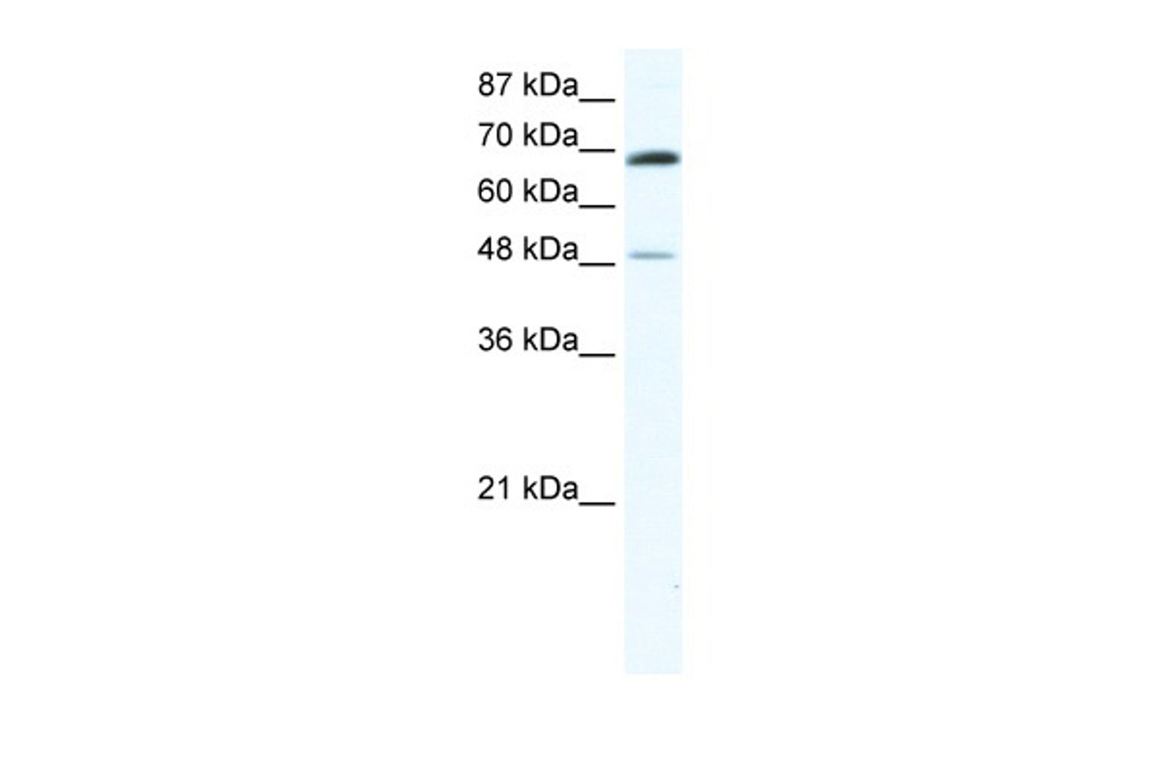 Antibody used in WB on Human Jurkat 0.2-1 ug/ml.