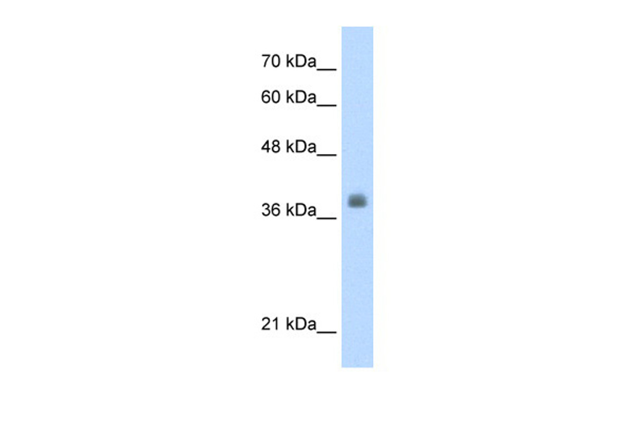 Antibody used in WB on Human HepG2 at 0.2-1 ug/ml.