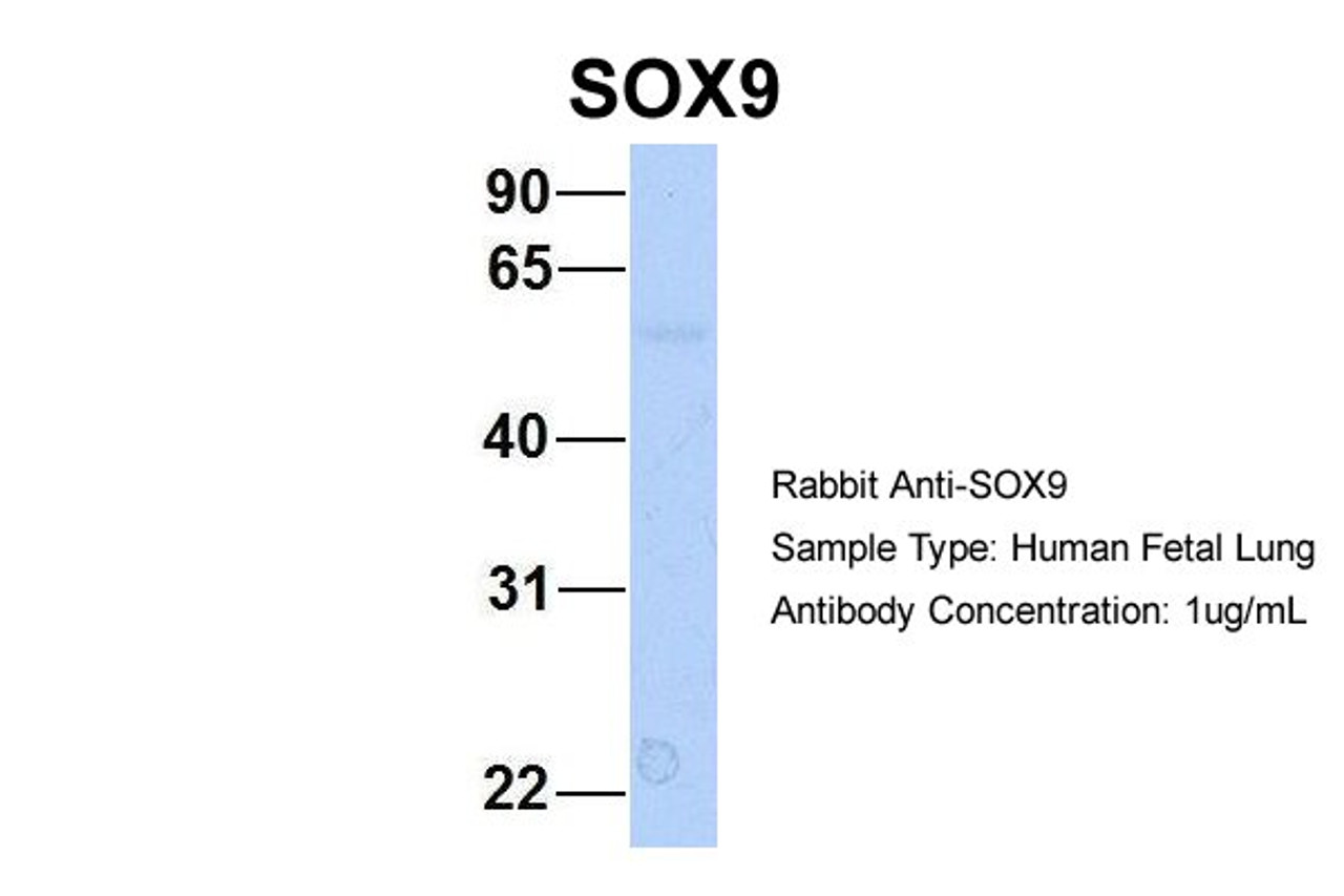 Antibody used in WB on Hum. Fetal Lung at 1 ug/ml.