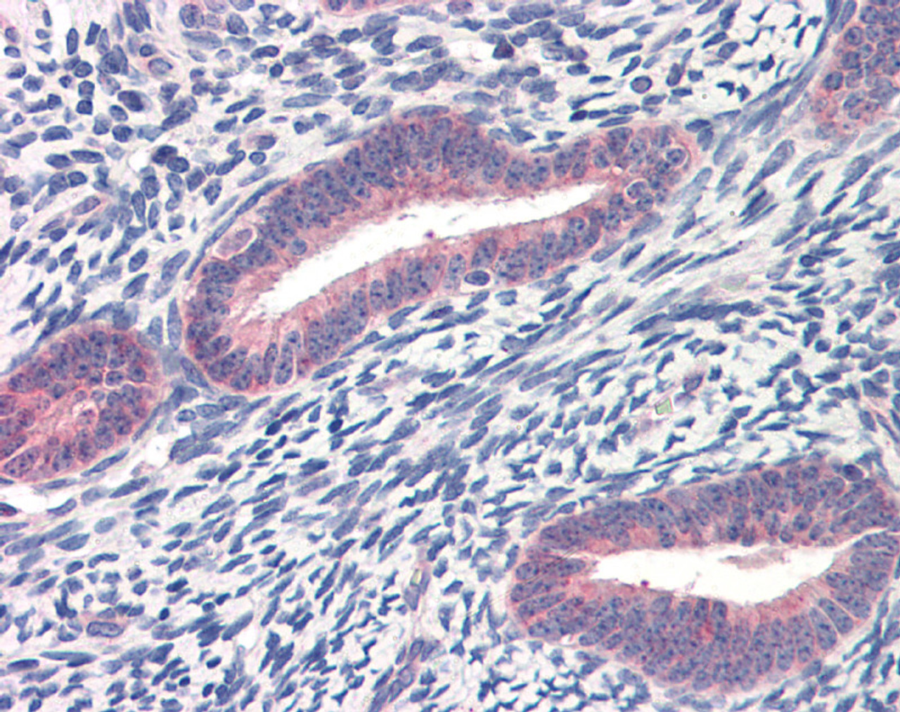 Antibody used in IHC on Human Uterus.