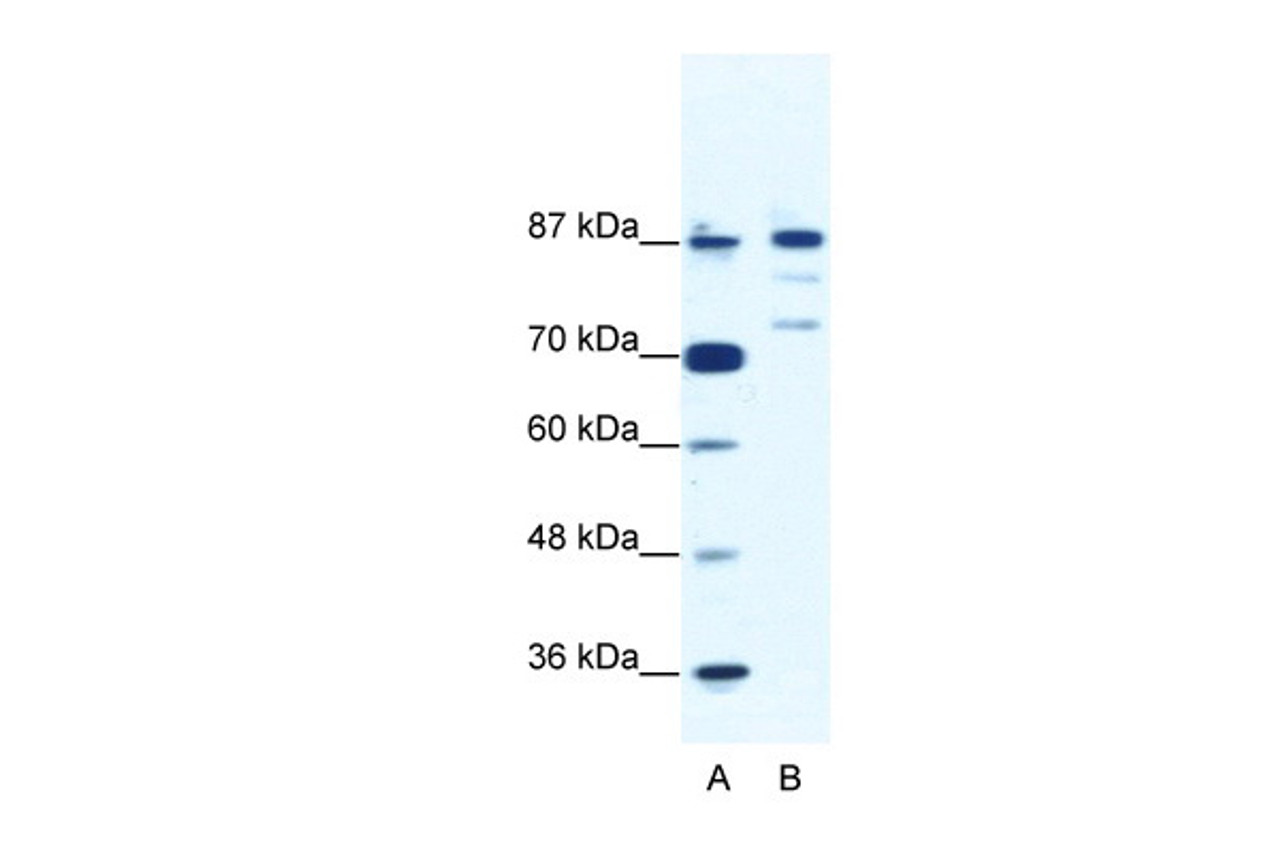 Antibody used in WB on Human Jurkat 1.25 ug/ml.