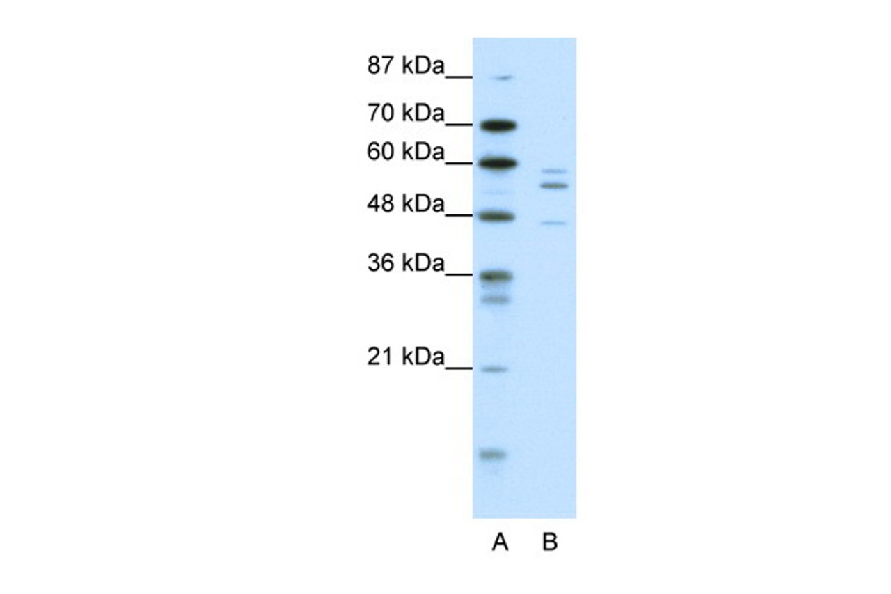 Antibody used in WB on Human HepG2 at 0.0625 ug/ml.