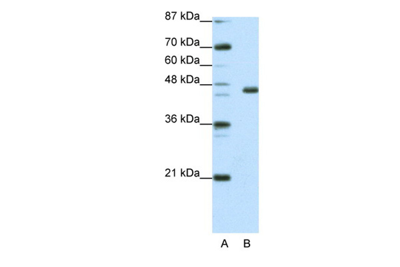 Antibody used in WB on Human Jurkat 0.0625 ug/ml.