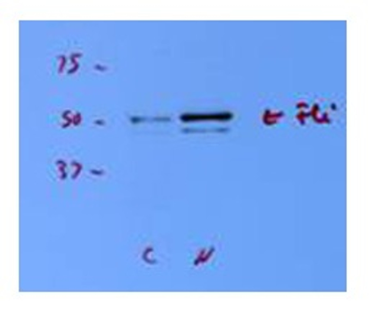 Antibody used in WB on Porcine endothelial at 1:1000.