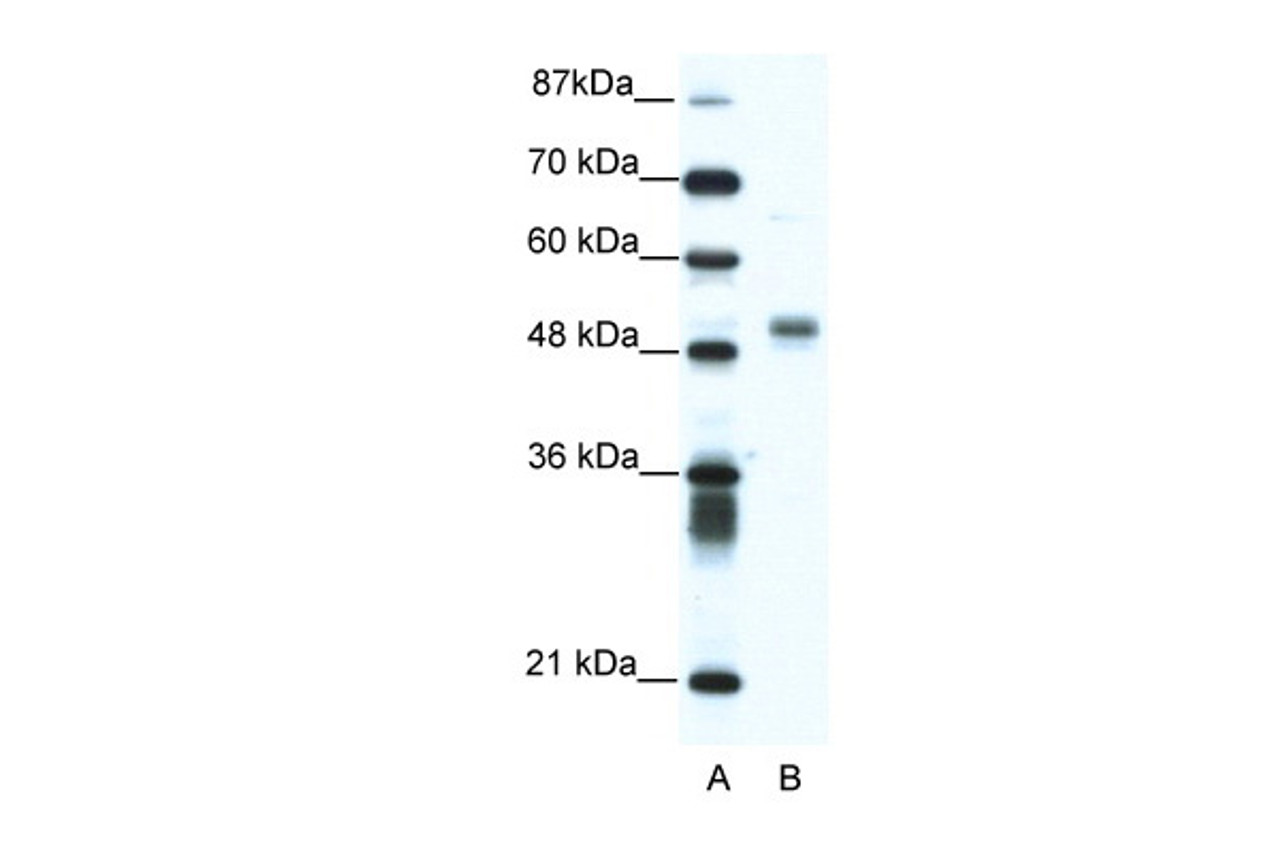 Antibody used in WB on Human Jurkat cells at 1.25 ug/ml.