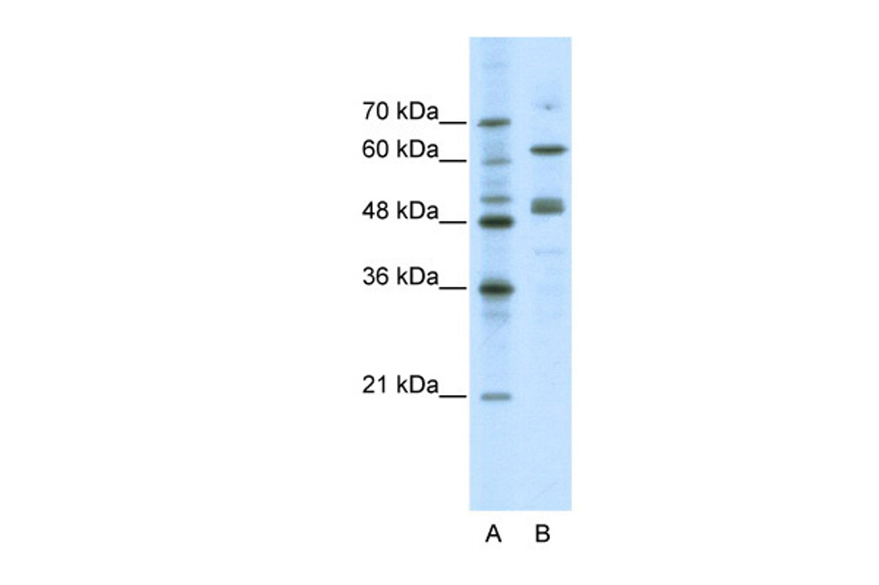 Antibody used in WB on Human Jurkat 0.2-1 ug/ml.