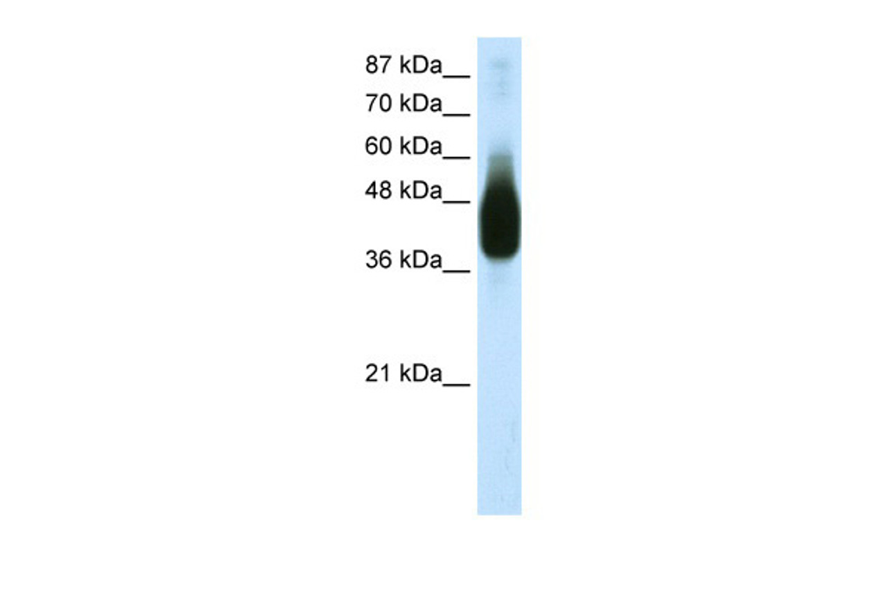 Antibody used in WB on Transfected 293T at 1.25 ug/ml.