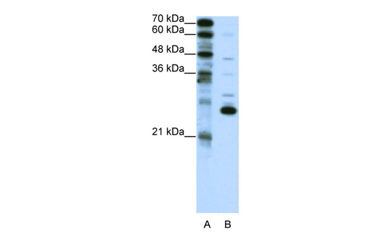 Antibody used in WB on Human Jurkat 0.2-1 ug/ml.