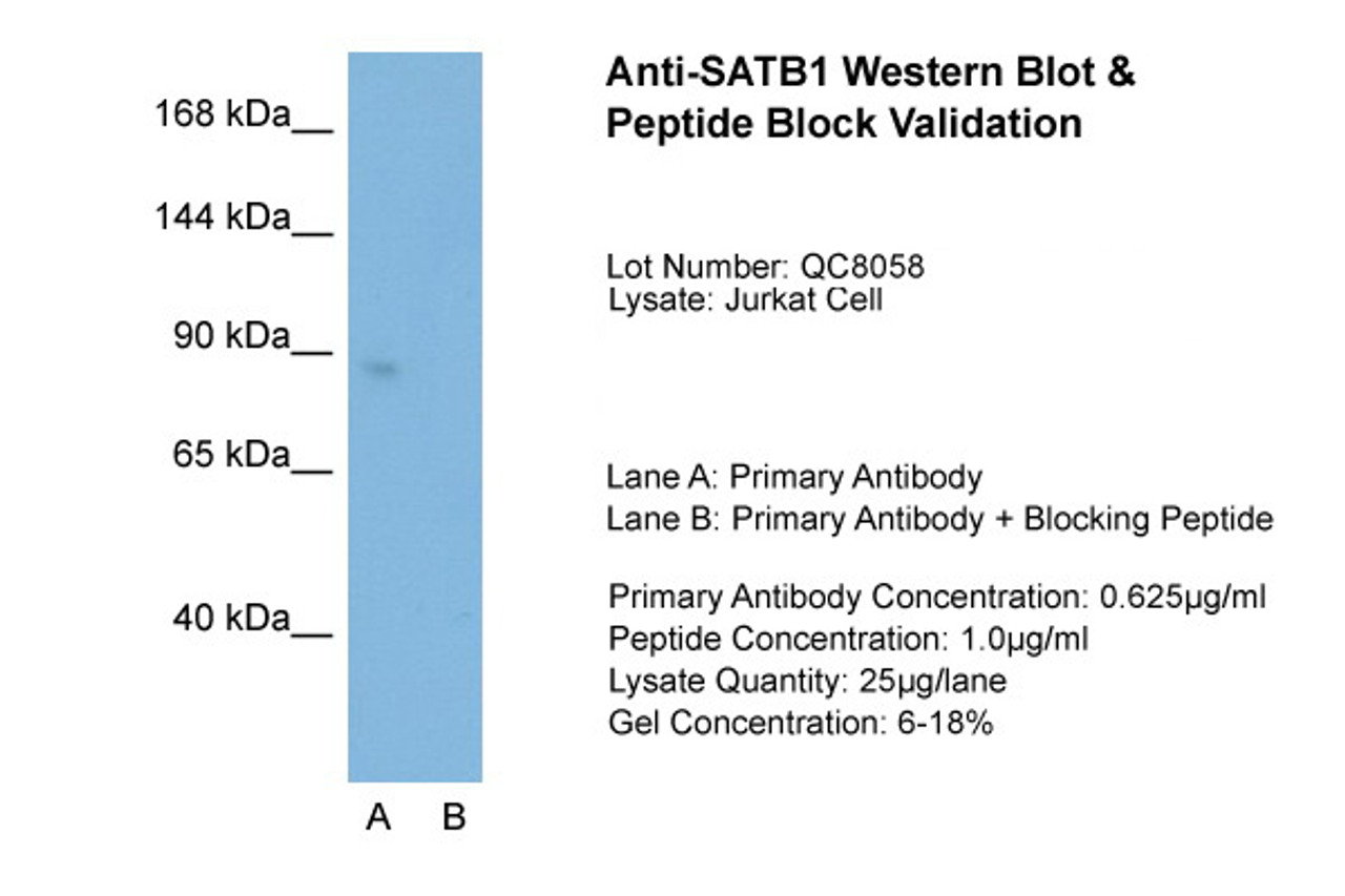 Antibody used in WB on Jurkat 0.625 ug/ml (Lane A: Primary Antibody and Lane B: Primary Antibody + Blocking Peptide ) .