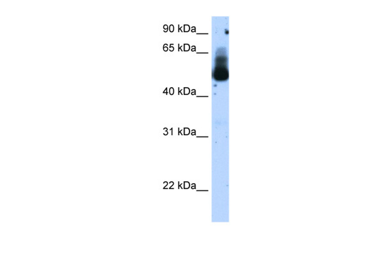 Antibody used in WB on Transfected 293T at 1.25 ug/ml.
