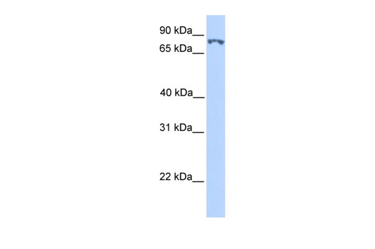 Antibody used in WB on Transfected 293T at 0.2-1 ug/ml.