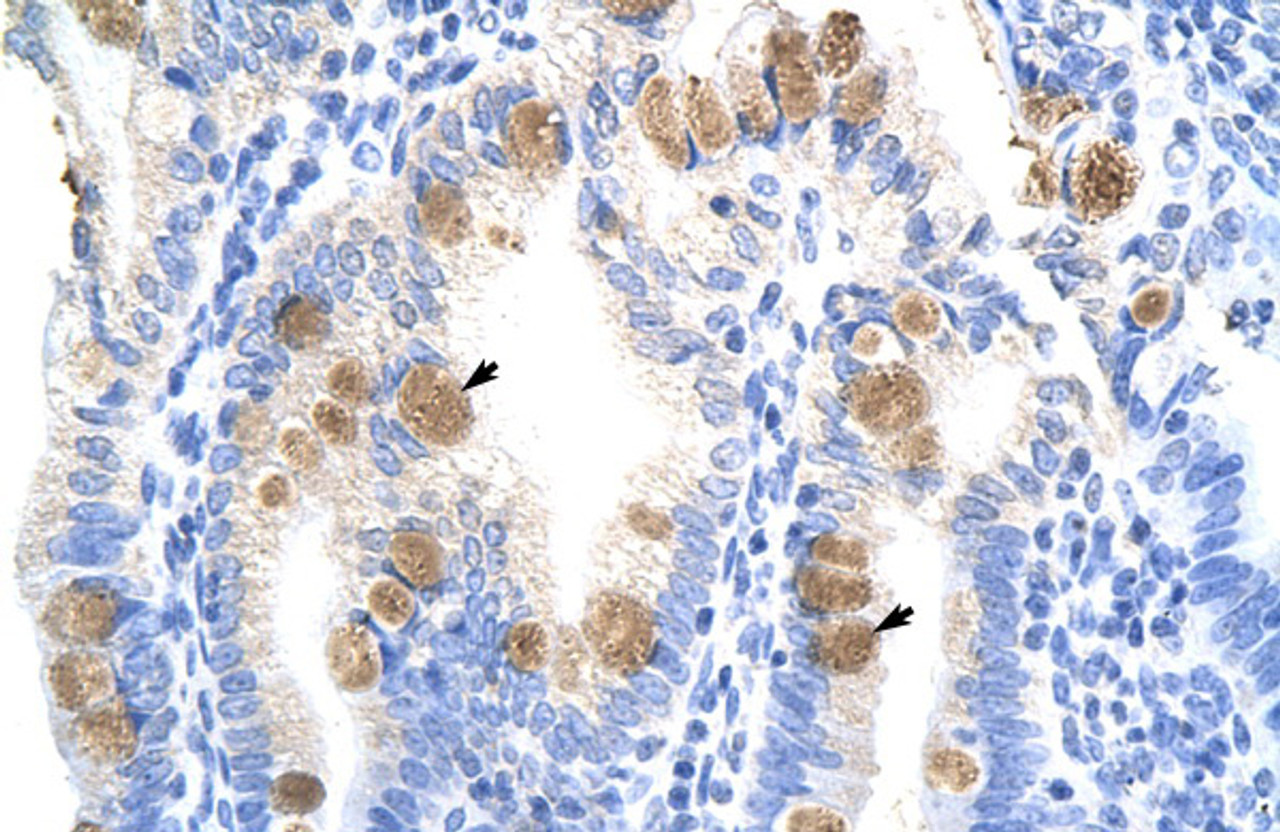 Antibody used in IHC on Human Intestine.