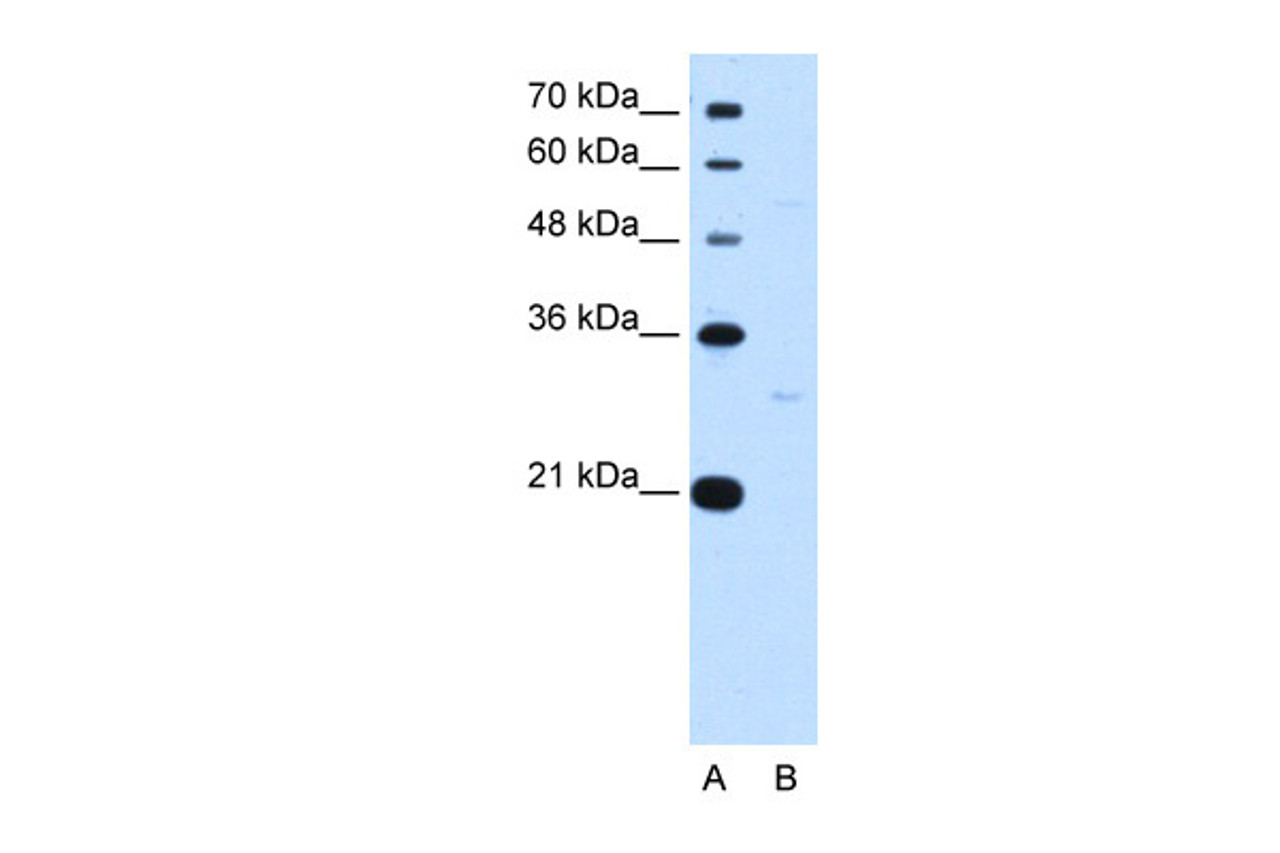 Antibody used in WB on Human HepG2 at 0.2-1 ug/ml.