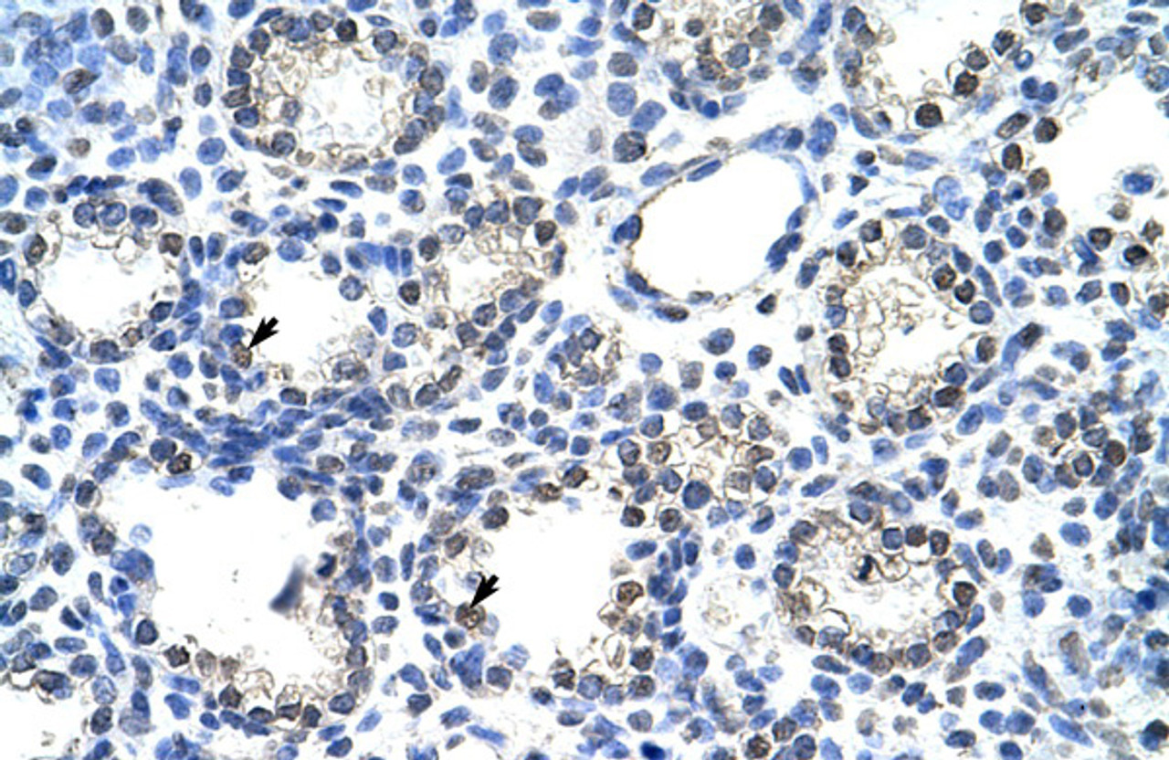 Antibody used in IHC on Human Lung.