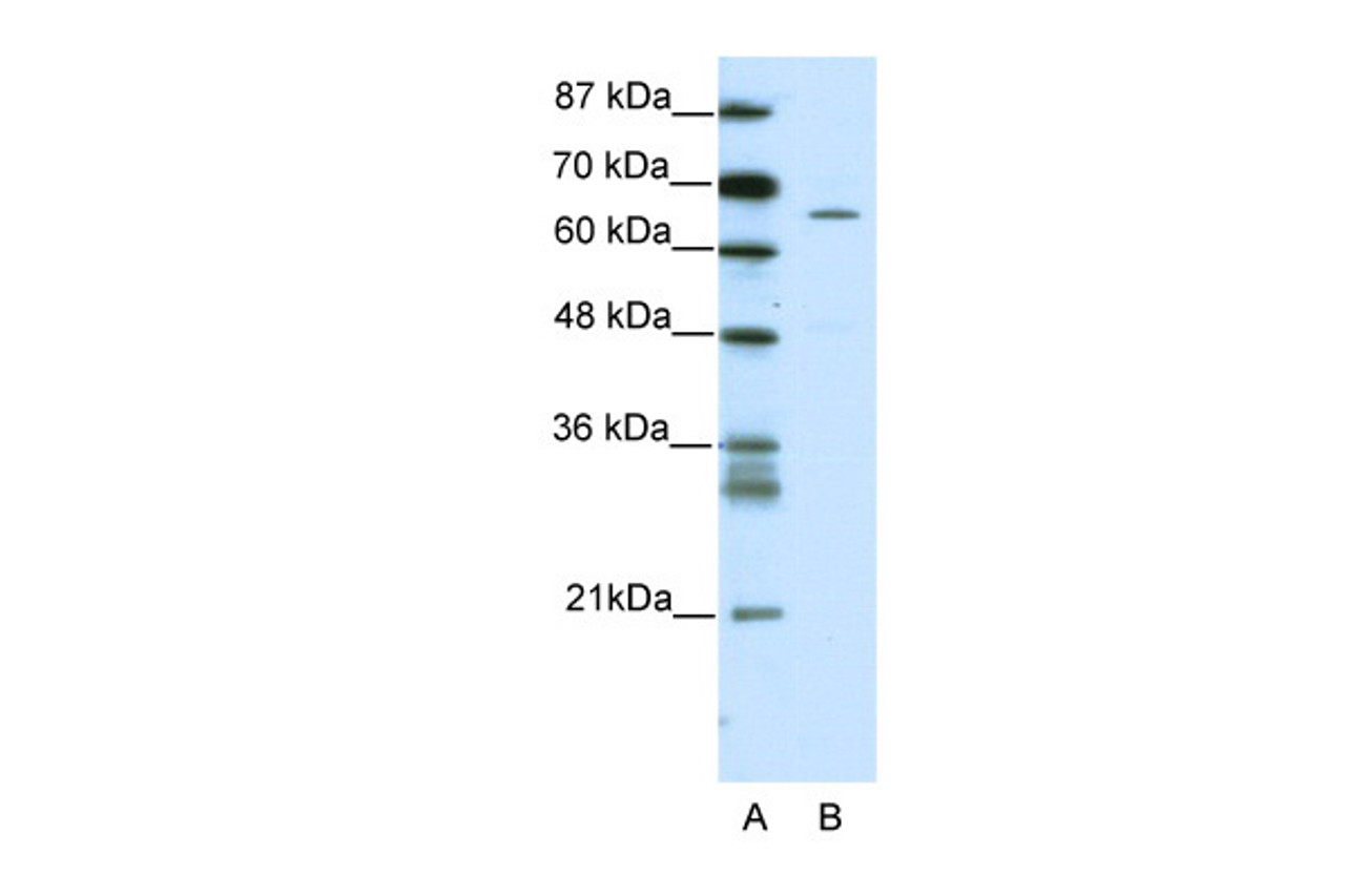 Antibody used in WB on Human Jurkat 5.0 ug/ml.