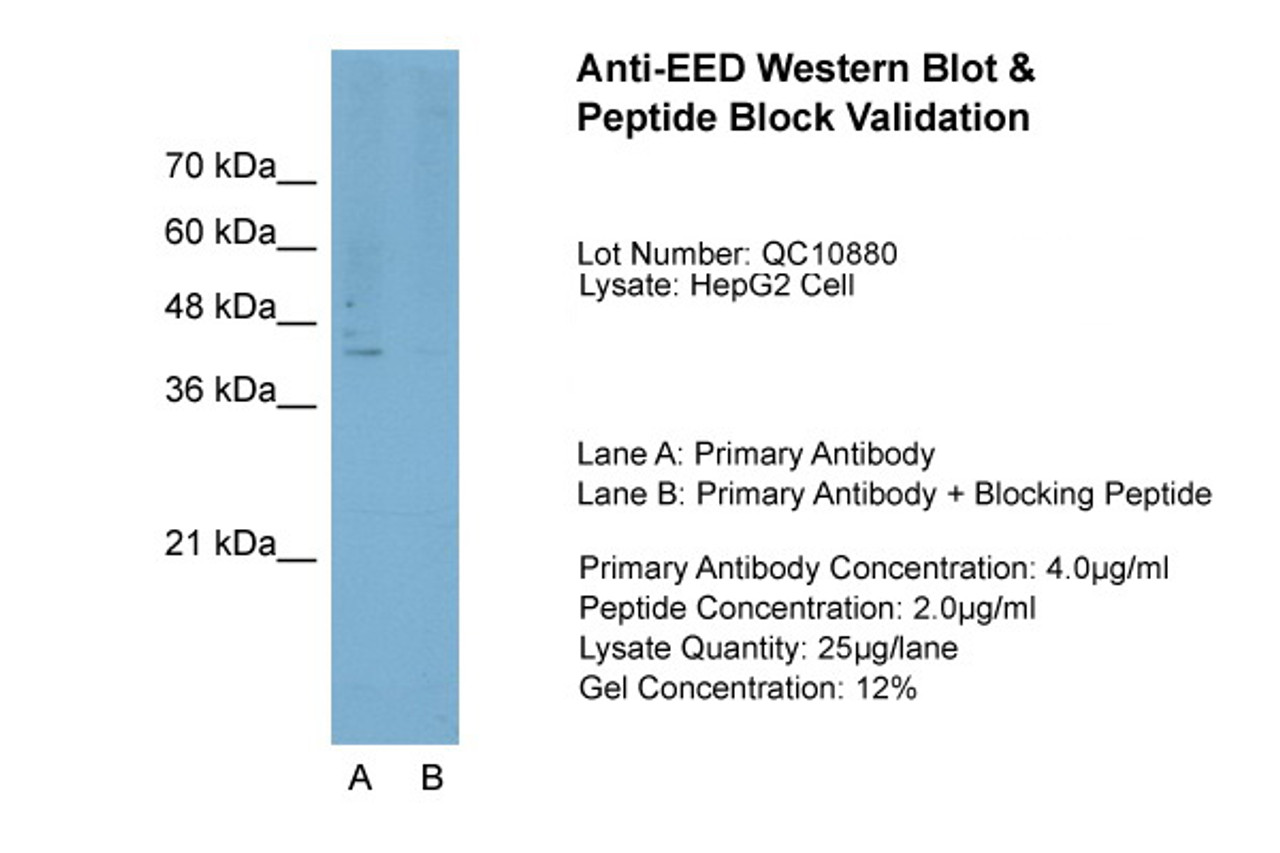 Antibody used in WB on HepG2 at 4.0 ug/ml (Lane A: Primary Antibody and Lane B: Primary Antibody + Blocking Peptide ) .