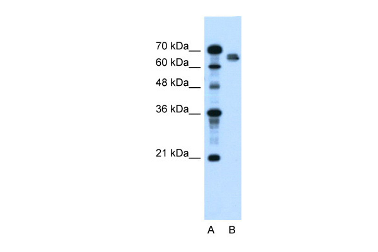 Antibody used in WB on Human HepG2 at 2.5 ug/ml.