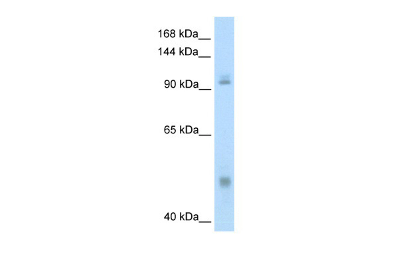 Antibody used in WB on Human Thymus at 0.2-1 ug/ml.