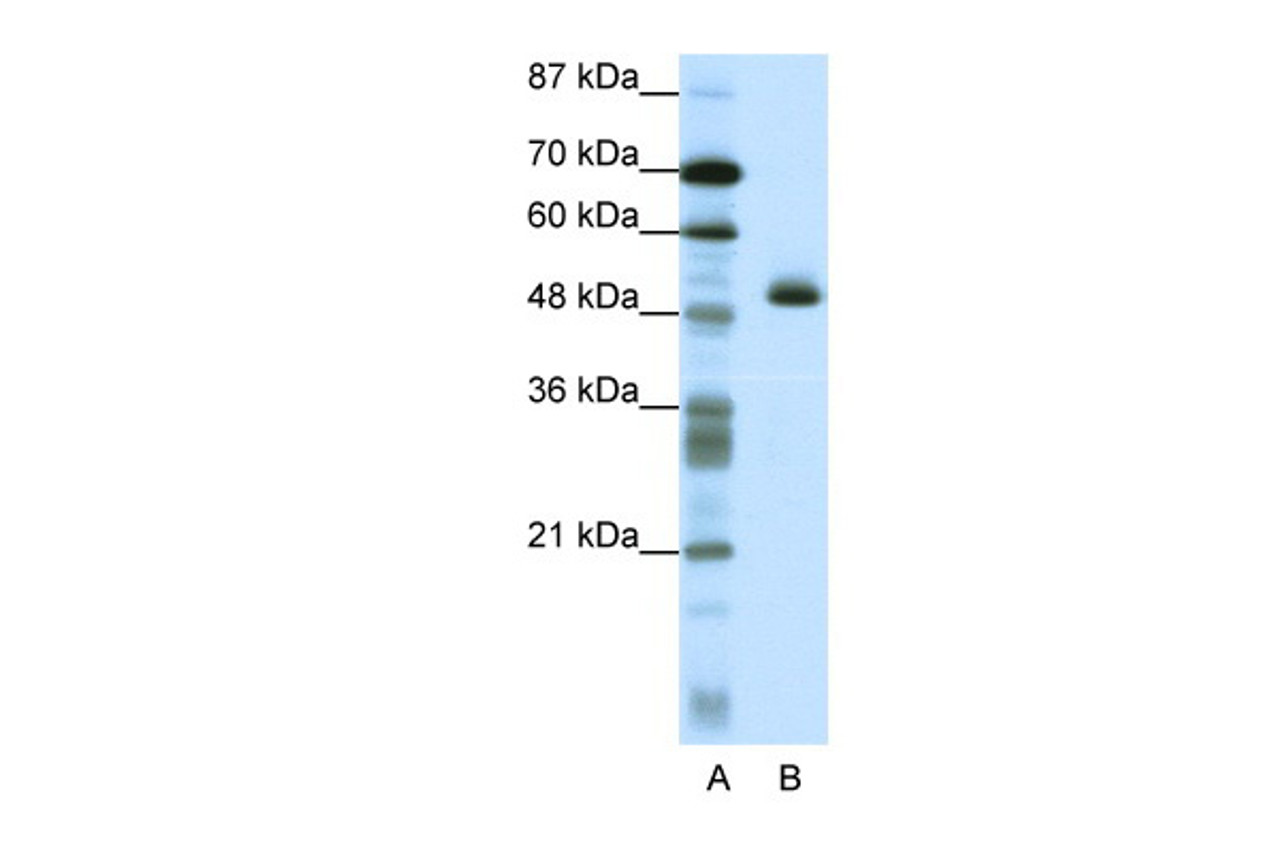 Antibody used in WB on Human HepG2 at 1.25 ug/ml.