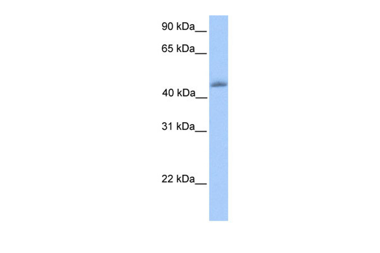 Antibody used in WB on Human heart at 0.2-1 ug/ml.