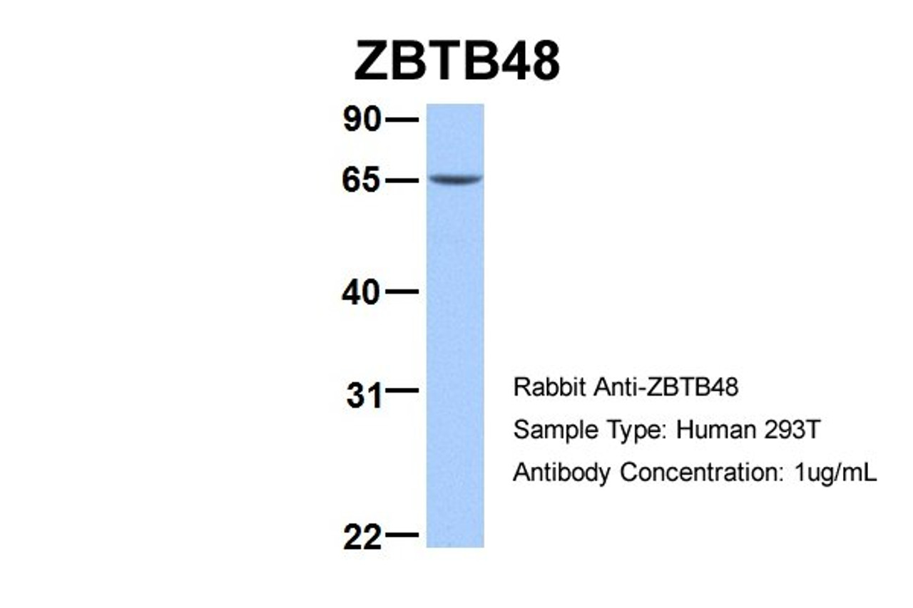 Antibody used in WB on Hum. Fetal Brain at 1 ug/ml.