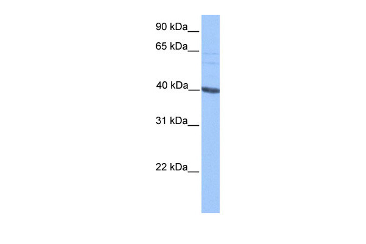 Antibody used in WB on Human HepG2 at 0.2-1 ug/ml.