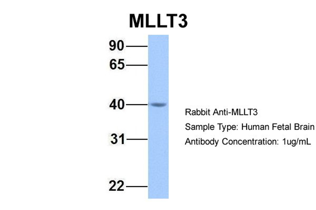 Antibody used in WB on Hum. Fetal Brain at 1 ug/ml.