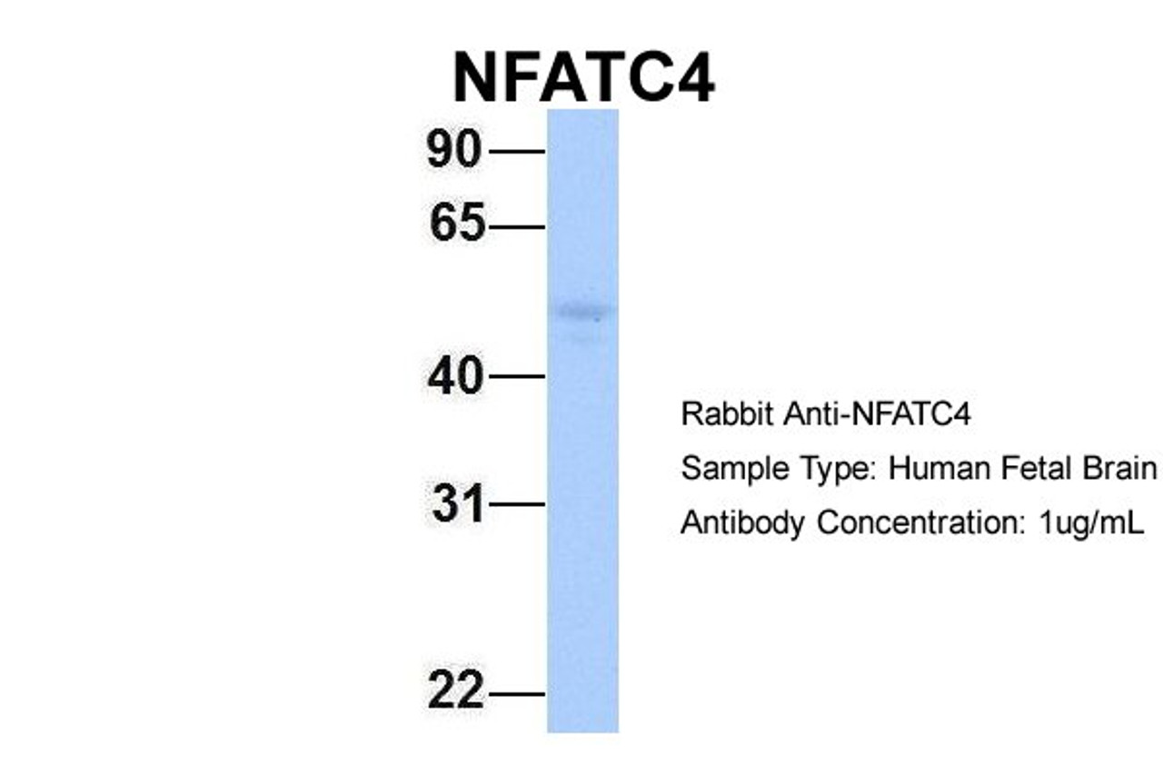 Antibody used in WB on Hum. Fetal Brain at 1 ug/ml.