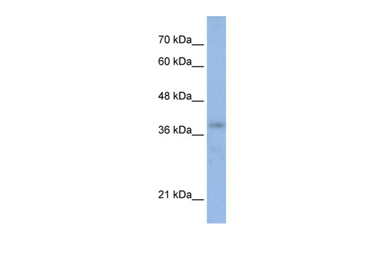 Antibody used in WB on Human HepG2 at 0.2-1 ug/ml.